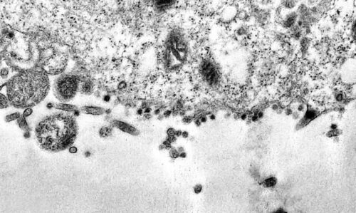 Visao microscopica de celula afetada pelo coronavirus Credito Fiocruz