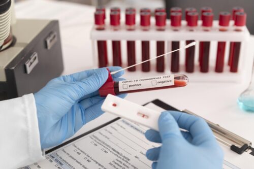 coronavirus test assortment in lab